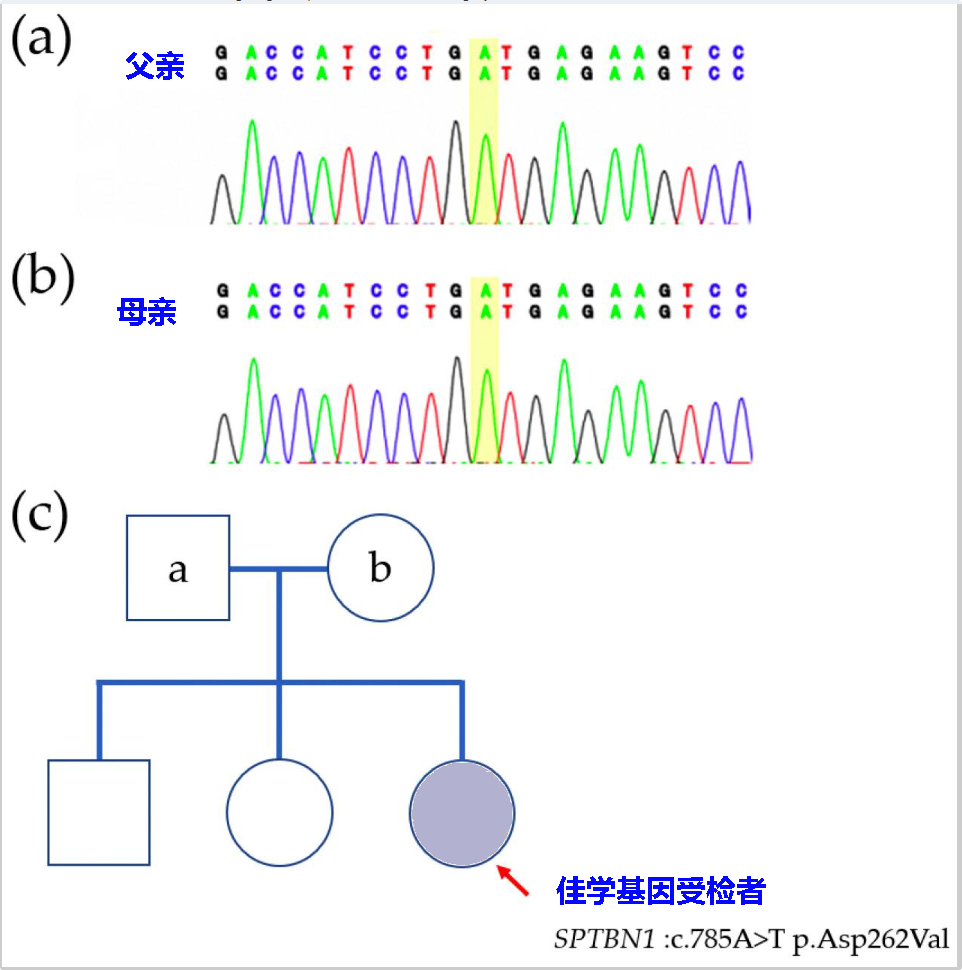 婴儿癫痫痉挛综合征家系图